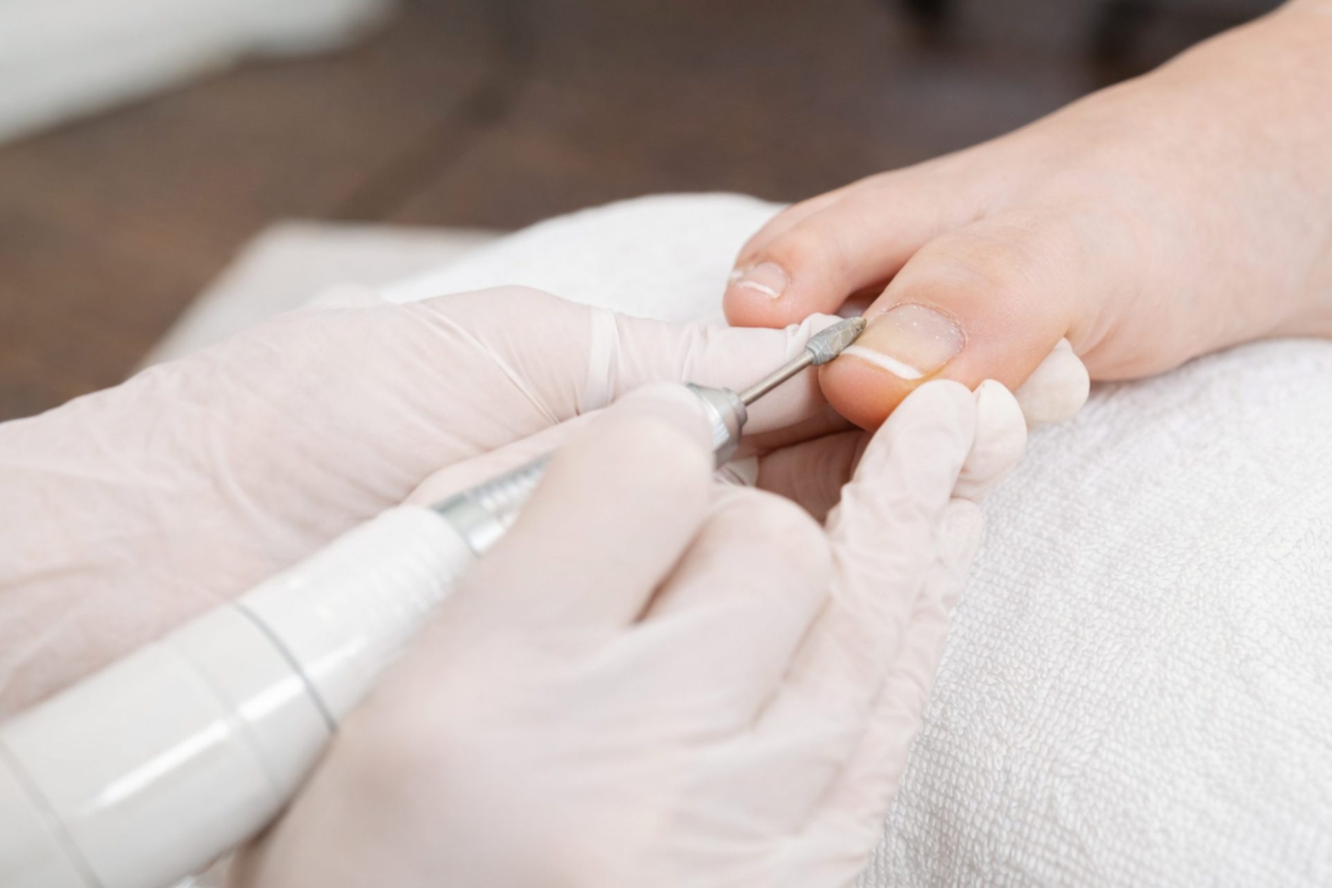INGROWN NAIL Treatment