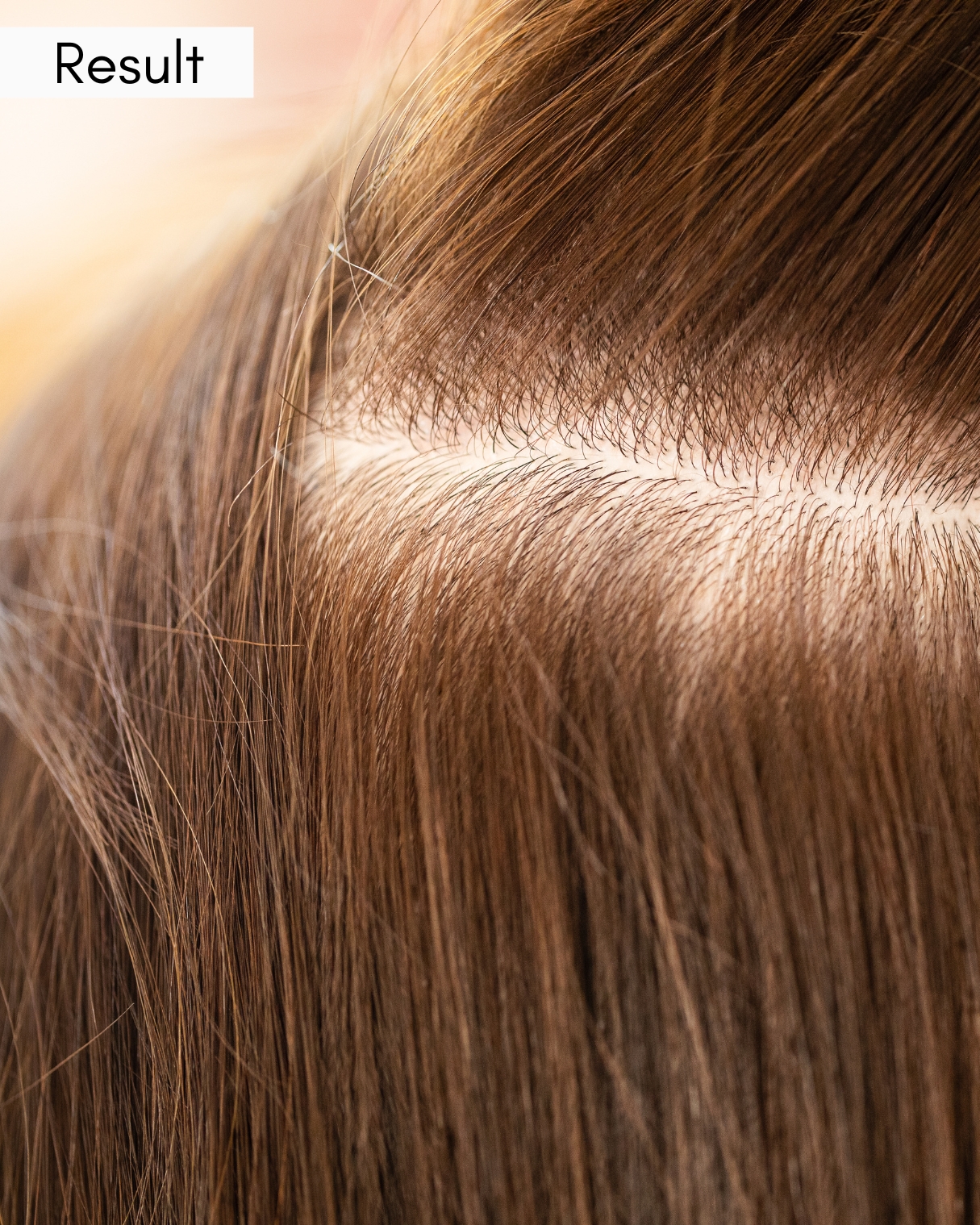 ผลลัพธ์ หลังทำ Symbiose Scalp Treatment